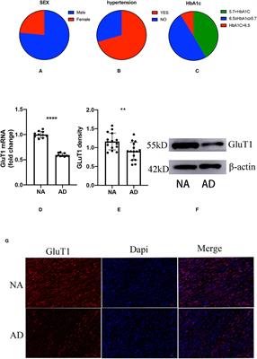 Insulin Resistance Promotes the Formation of Aortic Dissection by Inducing the Phenotypic Switch of Vascular Smooth Muscle Cells